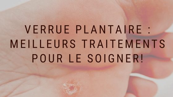 Verrue plantaire : Comment s’en débarrasser ?