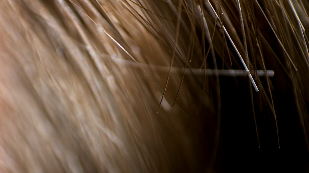 Squames et croûtes du cuir chevelu : 7 causes et solutions naturelles Squames cuir chevelu : gros plan sur des cheveux abîmés