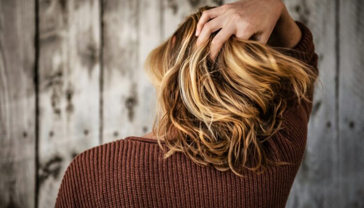 Cuir chevelu avec squames et démangeaisons, gros plan sur les cheveux