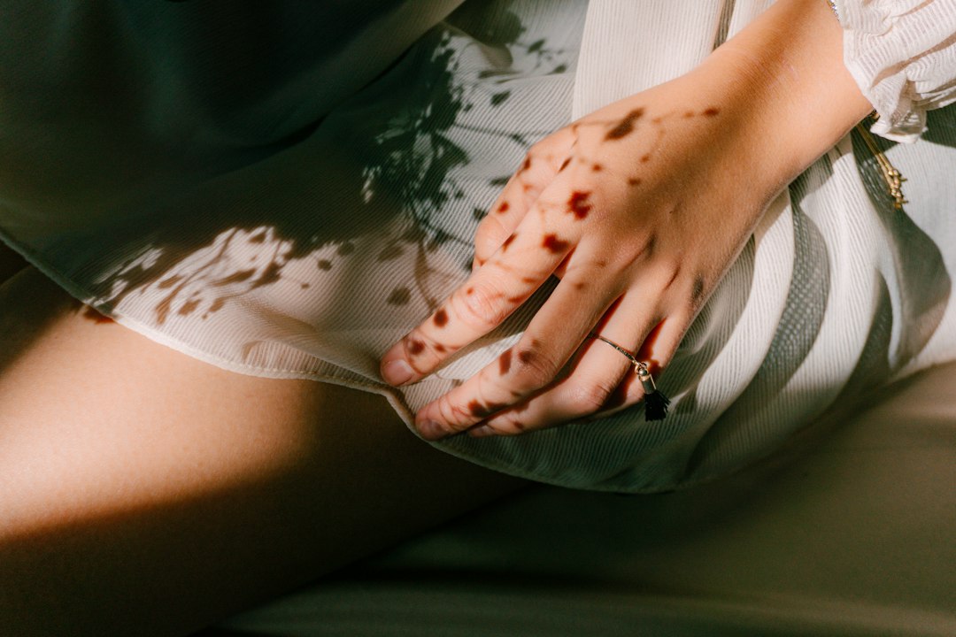 Cellulite cuisse : 7 solutions naturelles efficaces Peau des jambes montrant les irrégularités typiques de la cellulite cuisse