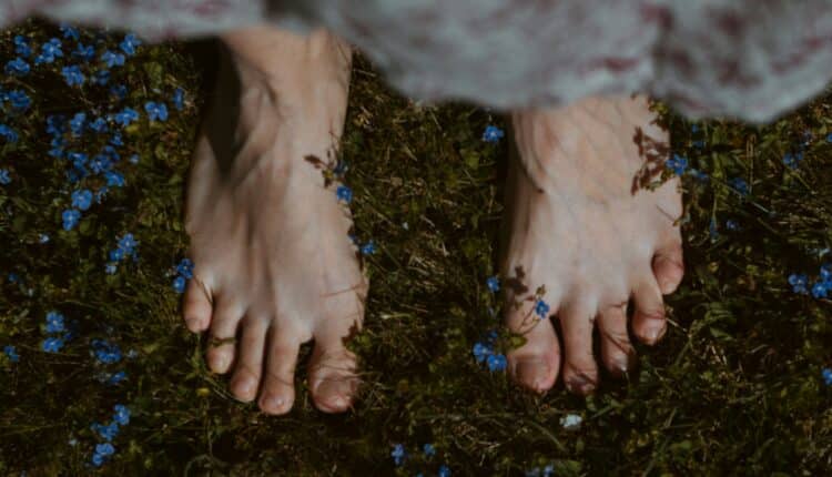 Verrue pied sur la plante du pied, gros plan sur la peau